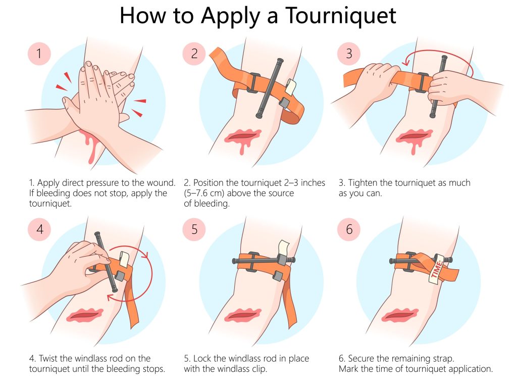 How to save a life after gunshot: A Guide to Saving a Life After a Gunshot Wound